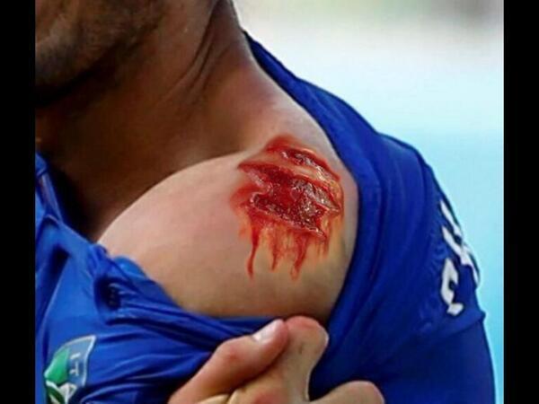 恶搞停不下来!苏亚雷斯咬人事件被制作成游戏