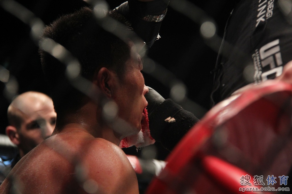 高清:UFC澳门赛王安莹苦战 血洒赛场拼到