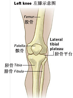胫骨内上髁位置图片